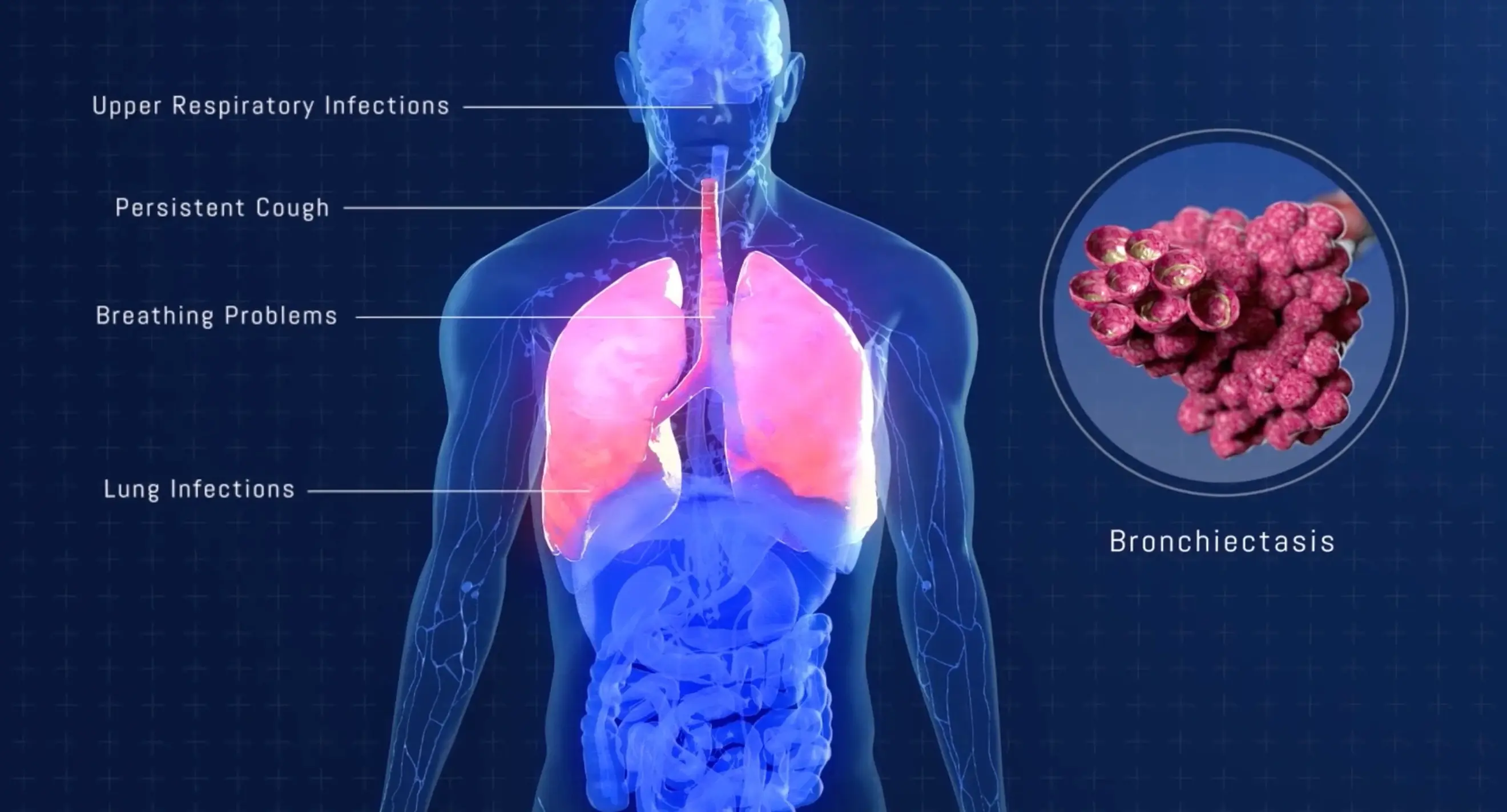 Pharming APDS mechanism of action 3D pharma animation