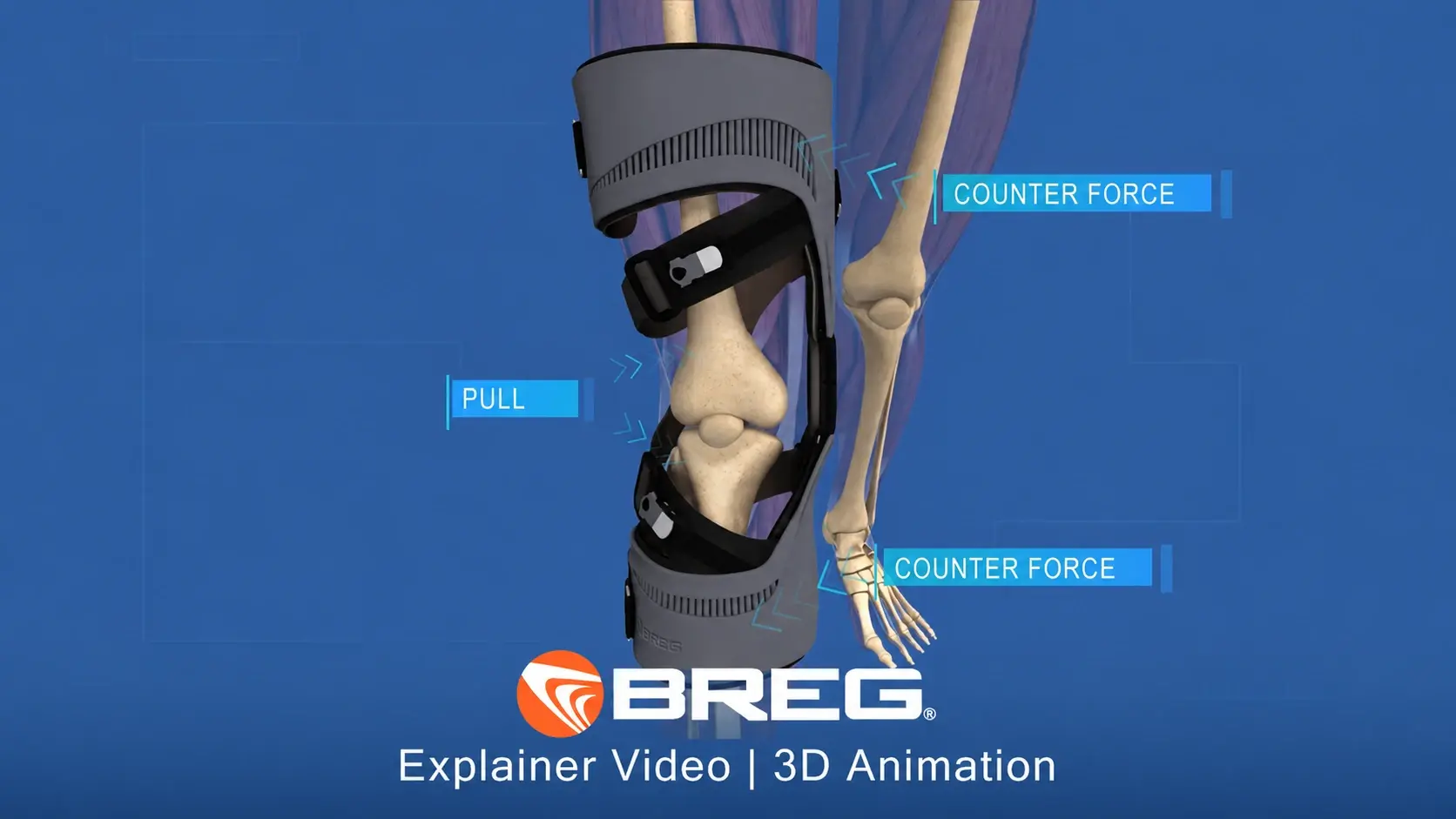 Breg Quantum OA knee brace 3D animation